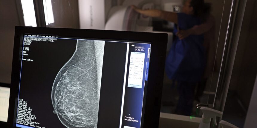 Mamografia digital para diagnóstico do câncer de mama