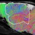 Pesquisa científica com organoides cerebrais