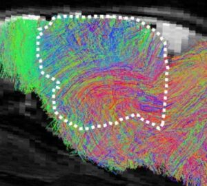 Pesquisa científica com organoides cerebrais