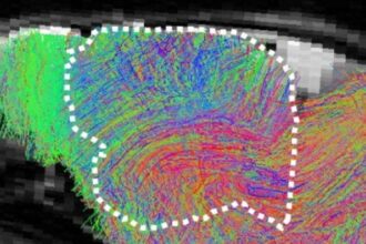 Pesquisa científica com organoides cerebrais