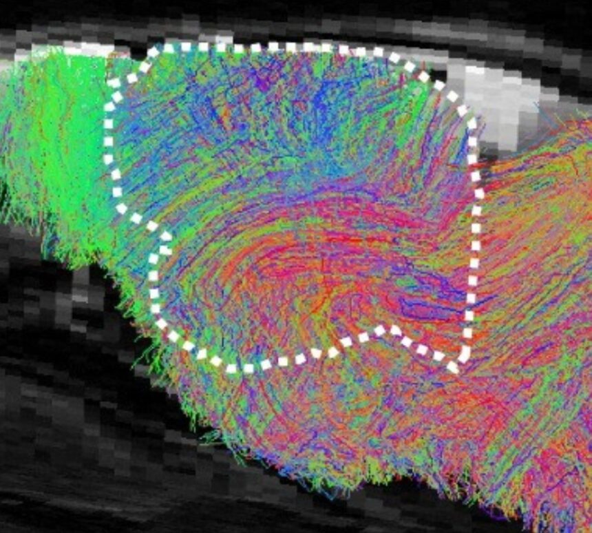 Pesquisa científica com organoides cerebrais