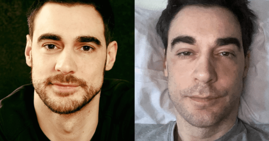 Ator francês teve complicações de uma cirurgia de hernia