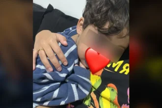 Criança de 3 anos volta para casa com hematomas no rosto após dia na creche