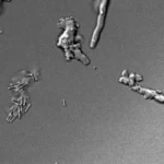 “Ameba de fogo”: cientistas descobrem espécie que sobrevive a 64 °C