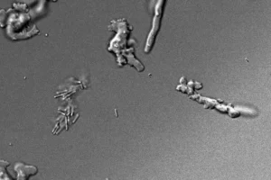 “Ameba de fogo”: cientistas descobrem espécie que sobrevive a 64 °C