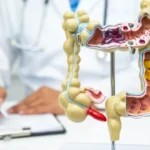 Exame médico e conceito de saúde intestinal