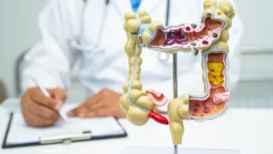 Exame médico e conceito de saúde intestinal