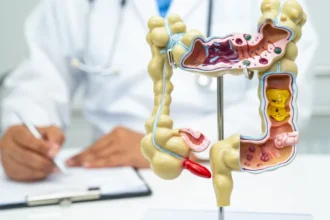 Exame médico e conceito de saúde intestinal