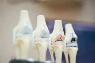 Pesquisa encontra partículas metálicas de próteses no cérebro humano