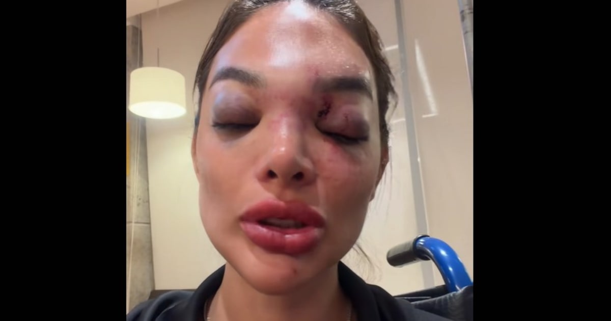 Empresário da Faria Lima é solto após 67 dias preso por agressão